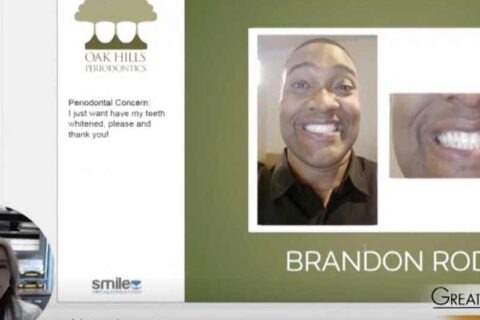 Man showing teeth Oak Hills